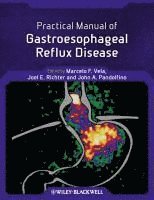 Marcelo F. Vela, Joel E. Richter, John E. Pandolfino, USA) Vela, Marcelo F. (Director of GI Motility, Gastroenterology Section, Baylor College of Medicine & Michael E. DeBakey VA Medical Center, Houston, TX, USA) Richter, Joel E. (Hugh Culverhouse Professor of Medicine, Director, Division of Gastroenterology and Nutrition, Director, Joy M. Culverhouse Center for Esophageal Diseases, University of South Florida, Tampa, FL, USA) Pandolfino, John E. (Department of Medicine, Division of Gastroenterology, Northwestern University, Chicago, IL, Marcelo F Vela, Joel E Richter, John E Pandolfino - Practical Manual of Gastroesophageal Reflux Disease, Häftad