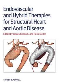 bokomslag Endovascular and Hybrid Therapies for Structural Heart and Aortic Disease