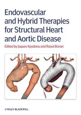 Endovascular and Hybrid Therapies for Structural Heart and Aortic Disease 1