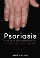 bokomslag Psoriasis