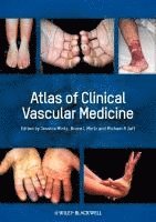 Atlas of Clinical Vascular Medicine 1