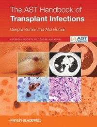 bokomslag AST Handbook of Transplant Infections