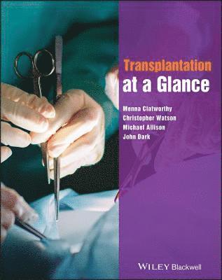 Menna Clatworthy, Christopher Watson, Michael Allison, John Dark - Transplantation at a Glance, Häftad