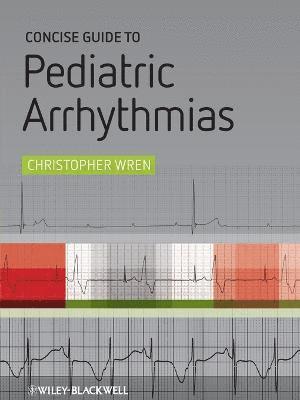 Christopher Wren - Concise Guide to Pediatric Arrhythmias, Häftad