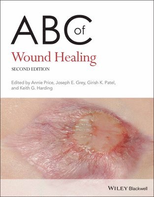 Annie Price, Joseph E. Grey, Girish K. Patel, Keith G. Harding - ABC of Wound Healing, Häftad