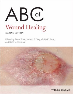 bokomslag ABC of Wound Healing