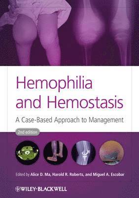 Hemophilia and Hemostasis 1