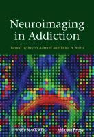 bokomslag Neuroimaging in Addiction