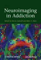 Neuroimaging in Addiction 1