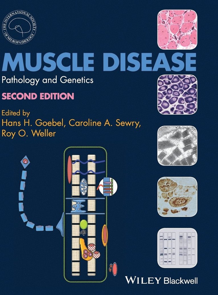 Muscle Disease 1