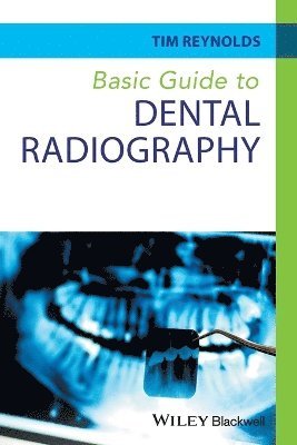 Tim Reynolds, UK) Reynolds, Tim (Education Consultant in Dental Radiology - Basic Guide to Dental Radiography, Häftad