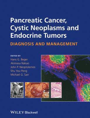 bokomslag Pancreatic Cancer, Cystic Neoplasms and Endocrine Tumors