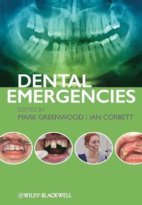 Dental Emergencies 1