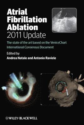 bokomslag Atrial Fibrillation Ablation, 2011 Update