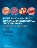 bokomslag Singer and Monaghan's Cervical and Lower Genital Tract Precancer