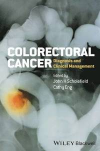 bokomslag Colorectal Cancer