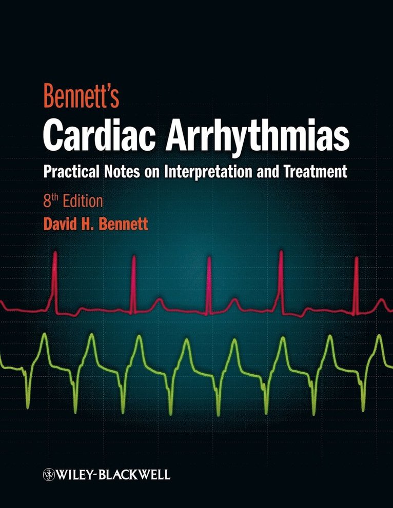 David H. Bennett, Bennett, David H Bennett - Bennett's Cardiac Arrhythmias, Häftad
