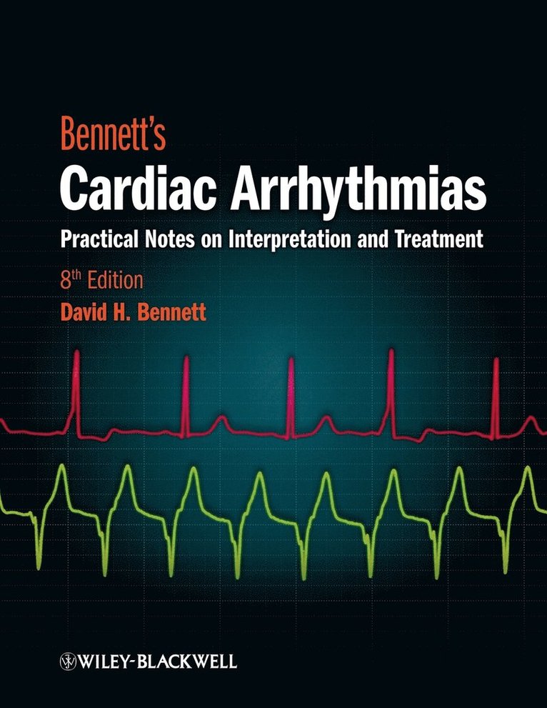 Bennett's Cardiac Arrhythmias 1