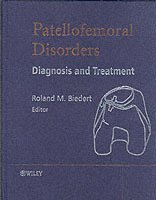 Patellofemoral Disorders