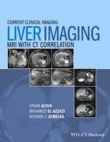 bokomslag Liver Imaging