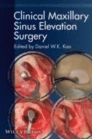 bokomslag Clinical Maxillary Sinus Elevation Surgery