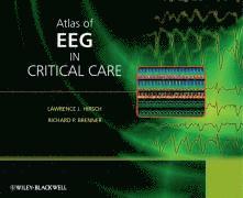 bokomslag Atlas of EEG in Critical Care