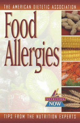 bokomslag Food Allergies