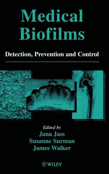 Jass, Jana Jass, Susanne Surman, James Walker - Medical Biofilms, Inbunden
