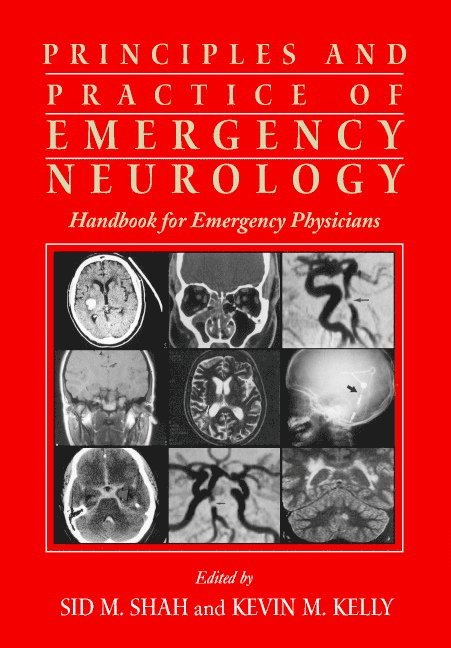 Sid M. Shah, Kevin M. Kelly, Sid M. (Michigan State University) Shah, Philadelphia) Kelly, Kevin M. (Drexel University, Sid M Shah, Kevin M Kelly - Principles and Practice of Emergency Neurology, Häftad