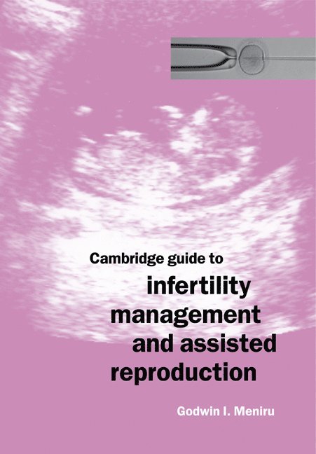 Cambridge Guide to Infertility Management and Assisted Reproduction 1