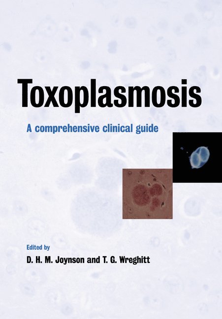 David H. M. Joynson, Tim G. Wreghitt, Swansea) Joynson, David H. M. (Singleton Hospital, Cambridge) Wreghitt, Tim G. (Addenbrooke's Hospital - Toxoplasmosis, Häftad