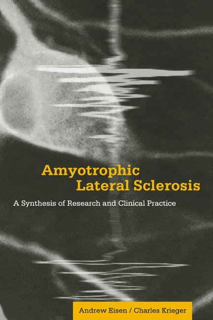 Amyotrophic Lateral Sclerosis 1