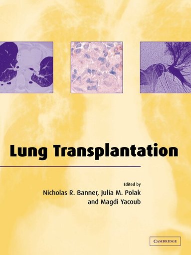 Nicholas R. Banner, Nicholas R. Banner, Julia M. Polak, Magdi H. Yacoub - Lung Transplantation, Häftad
