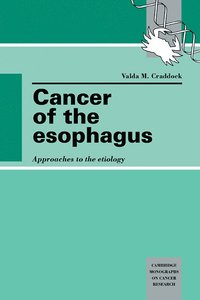 bokomslag Cancer of the Esophagus