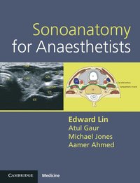 bokomslag Sonoanatomy for Anaesthetists
