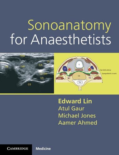 Edward Lin, Atul Gaur, Michael Jones, Aamer Ahmed - Sonoanatomy for Anaesthetists, Häftad