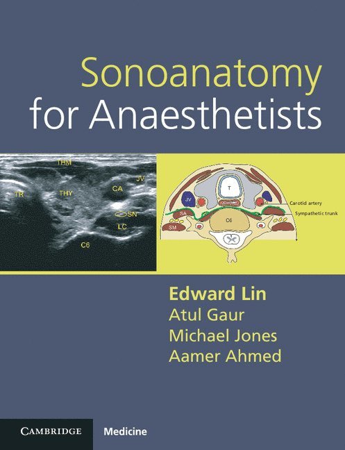 Sonoanatomy for Anaesthetists 1