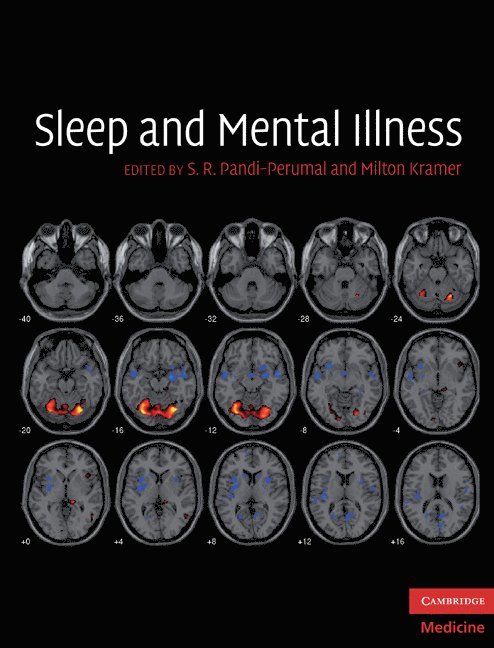 Sleep and Mental Illness