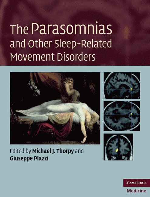 The Parasomnias and Other Sleep-Related Movement Disorders 1