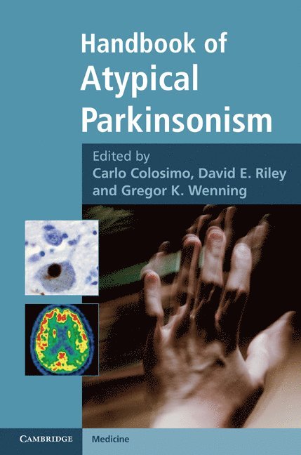 Handbook of Atypical Parkinsonism