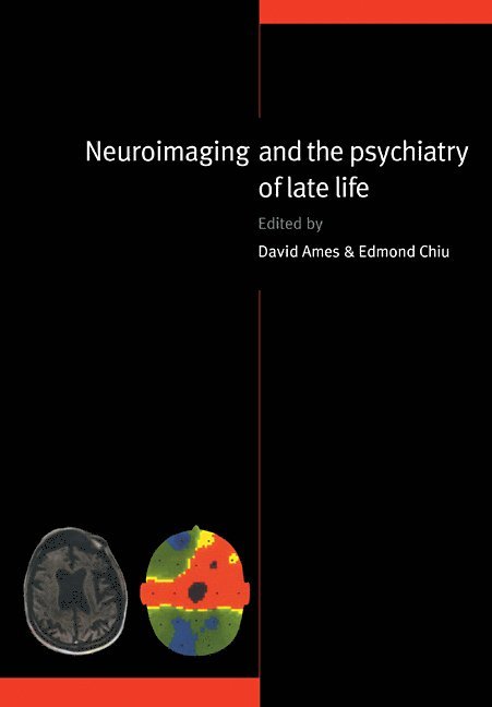 David Ames, Edmond Chiu, David (University of Melbourne) Ames, Edmond (University of Melbourne) Chiu - Neuroimaging and the Psychiatry of Late Life, Häftad