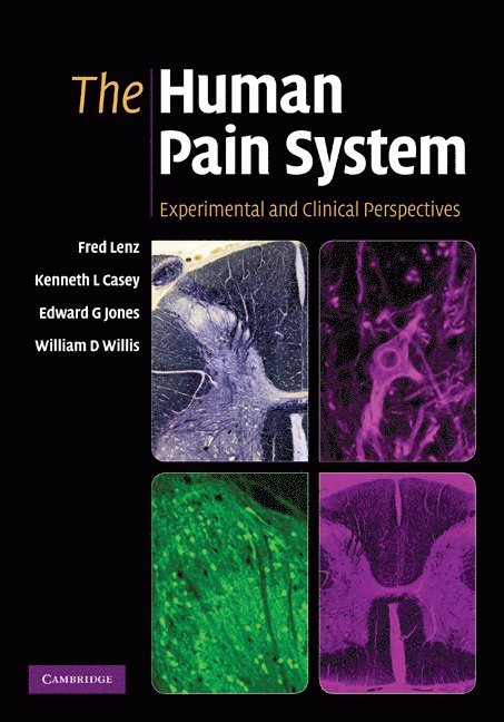 Frederick A. Lenz, Kenneth L. Casey, Edward G. Jones, William D. Willis - Human Pain System, Inbunden