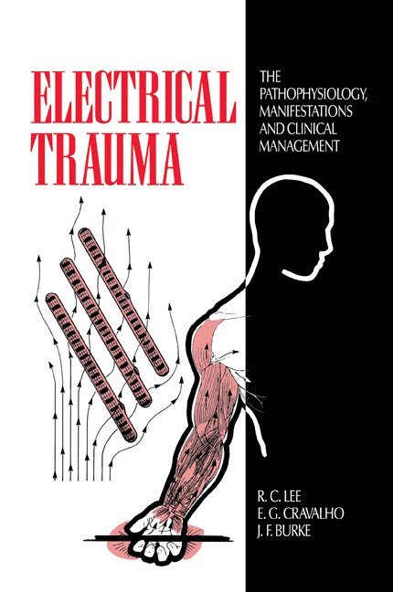 Electrical Trauma 1