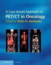 bokomslag Case-Based Approach to PET/CT in Oncology