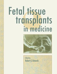 bokomslag Fetal Tissue Transplants in Medicine