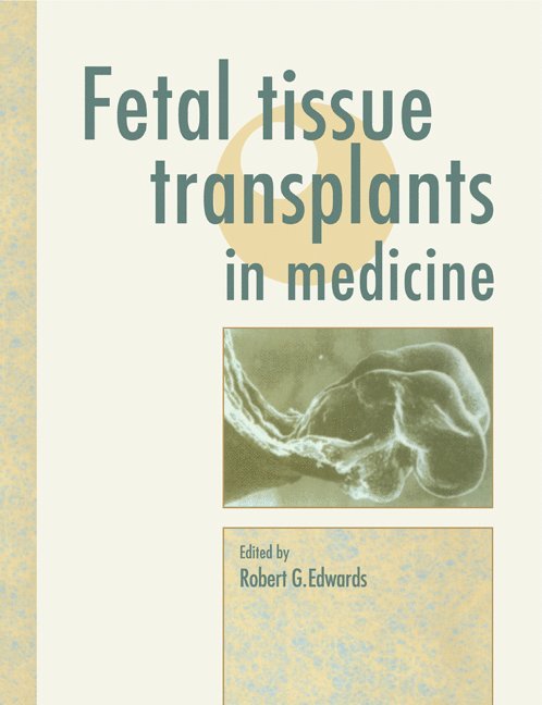 Fetal Tissue Transplants in Medicine 1