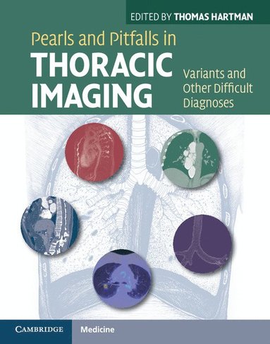 bokomslag Pearls and Pitfalls in Thoracic Imaging