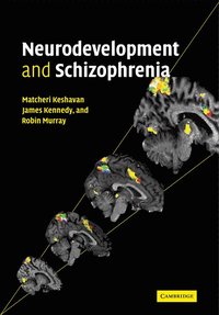 bokomslag Neurodevelopment and Schizophrenia
