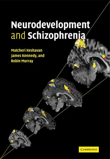 Matcheri S. Keshavan, James L. Kennedy, Robin M. Murray - Neurodevelopment and Schizophrenia, Häftad