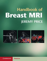 bokomslag Handbook of Breast MRI